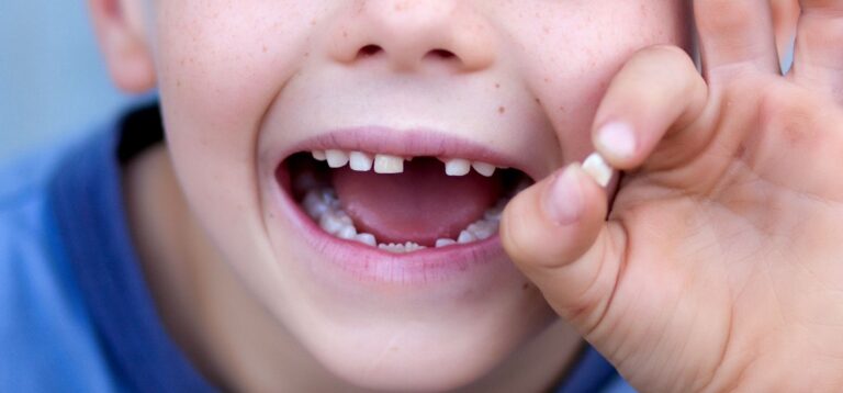 Should You Tighten a Loose Tooth at Home? What Parents Need to Know
